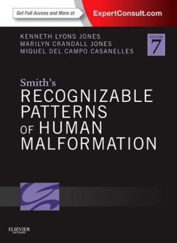 Smith’s Recognizable Patterns of Human Malformation : Expert Consult – Online…
