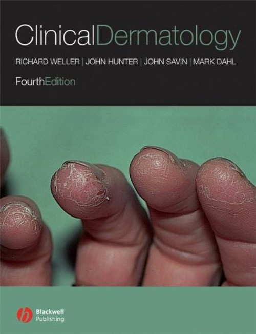 Clinical Dermatology Paperback
