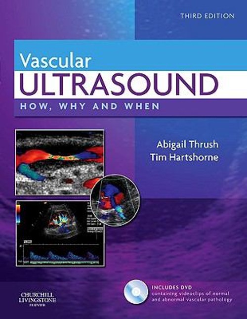 Vascular Ultrasound : How, Why and When Hardcover