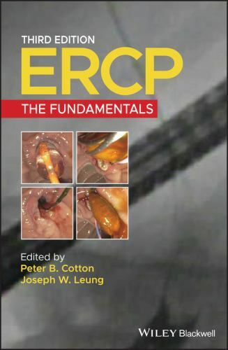 Ercp : The Fundamentals, Hardcover by Cotton, Peter B. (EDT); Leung, Joseph W…
