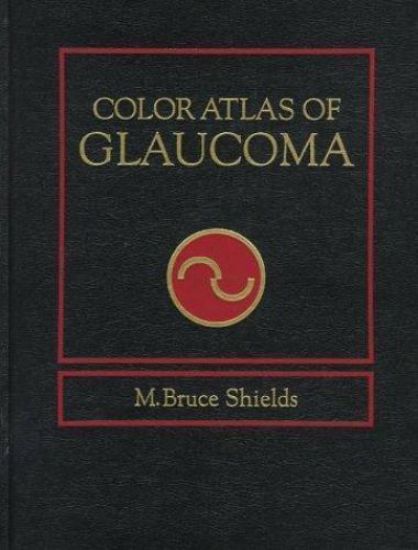Color Atlas of Glaucoma by M. Bruce Shields