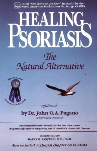 Healing Psoriasis: The Natural Alternative Pagano, John O. A. paperback Used –