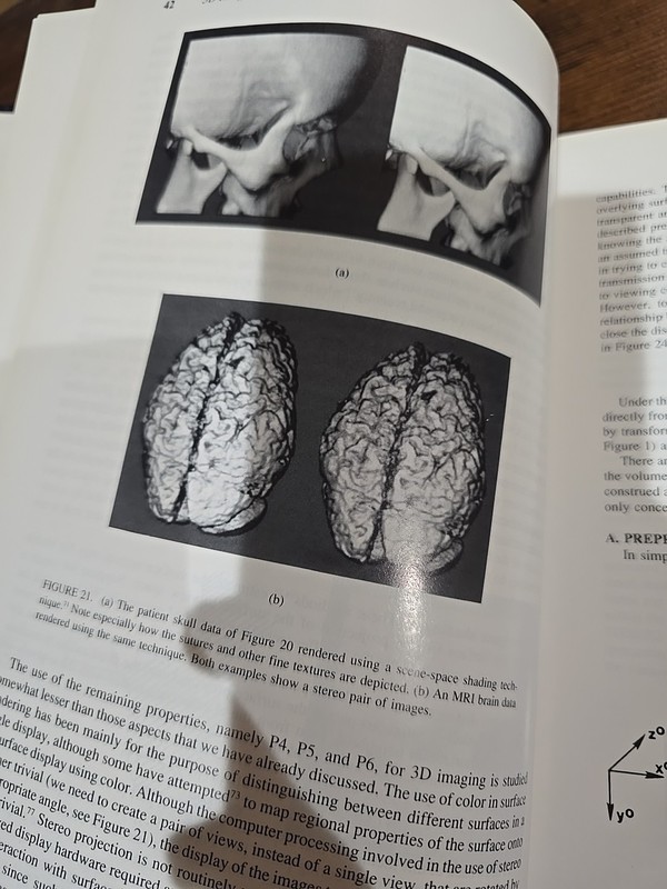 3D Imaging in Medicine - Hardcover - Jayaram K. Udupa & Gabor T. Herman - CRC... gallery