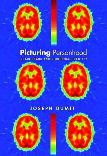 Joseph Dumit Picturing Personhood (Paperback) In-Formation