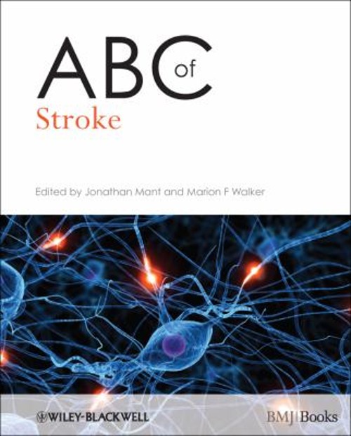 ABC of Stroke Paperback