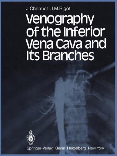 Venography of the Inferior Vena Cava and Its Branches, Paperback by Chermet, …