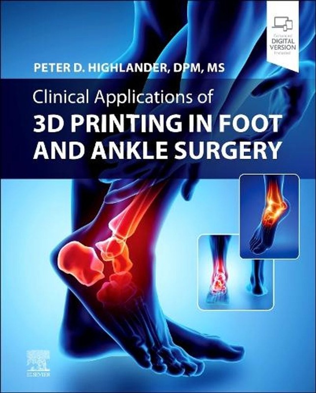 Clinical Applications of 3D Printing in Foot and Ankle Surgery by Peter D. Highl