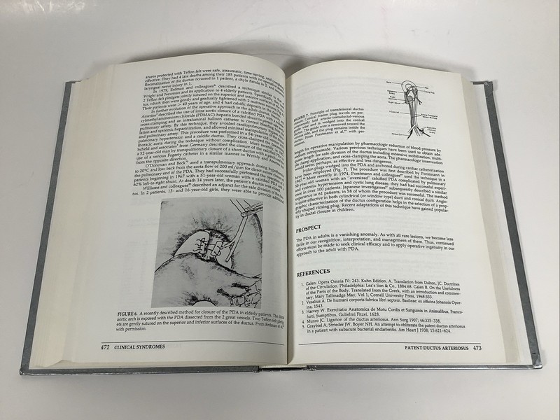 Adult Congenital Heart Disease by William C. Roberts - HARDCOVER - gallery