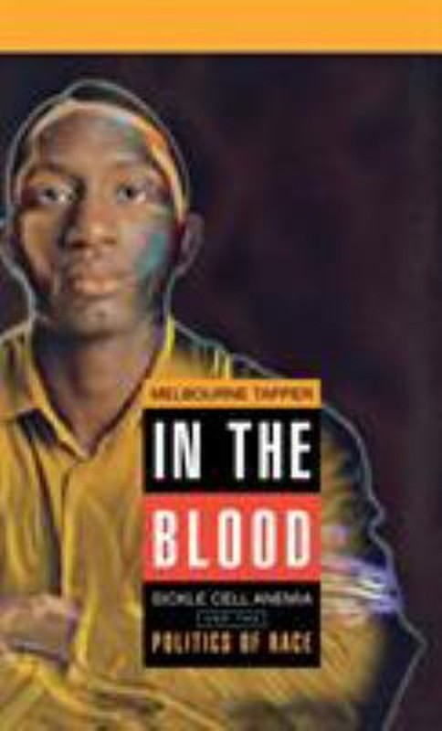 In the Blood : Sickle Cell Anemia and the Politics of Race Melbou