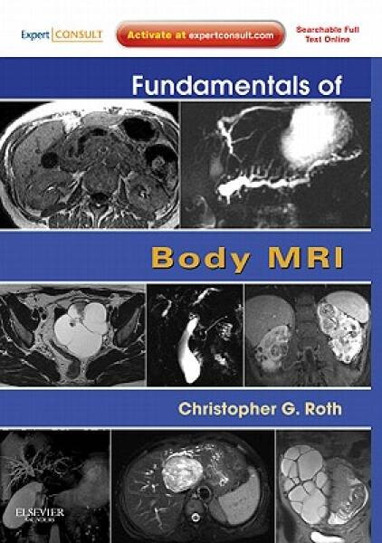 Fundamentals of Body MRI: Expert Consult- Online and Print, 1e (Fundament – GOOD