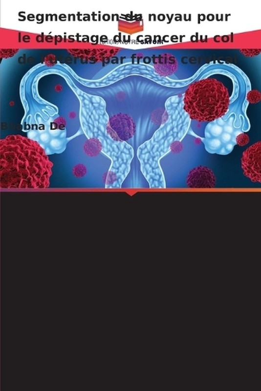 Segmentation du noyau pour le dpistage du cancer du col de l’utrus par frottis c