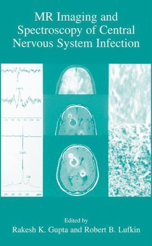 Mr Imaging and Spectroscopy of Central Nervous System Infection, Hardcover by…