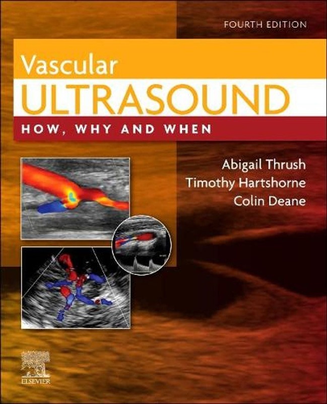 Vascular Ultrasound: How, Why and When 4th Edition by Abigail Thrush (English) H