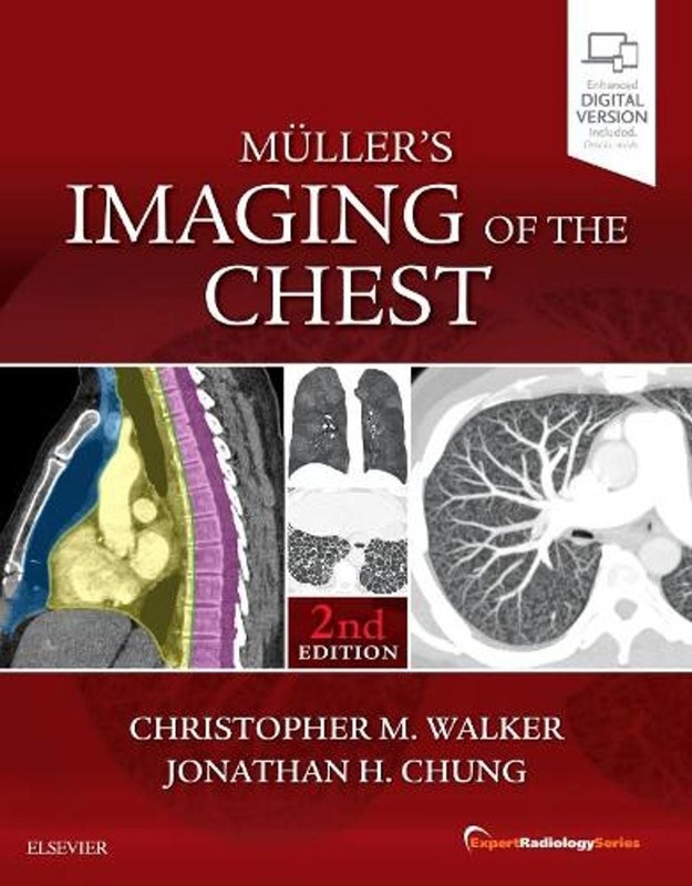 Muller’s Imaging of the Chest: Expert Radiology Series by Christopher M. Walker
