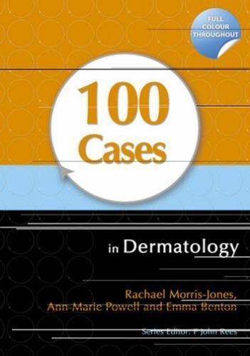 100 Cases in Dermatology, Paperback by Morris-Jones, Rachael, Ph.D.; Powell, …
