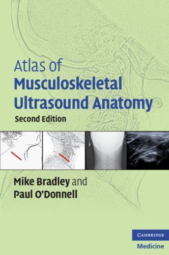 Atlas of Musculoskeletal Ultrasound Anatomy by Bradley, Mike; O’Donnell, Paul