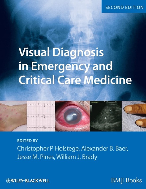 Visual Diagnosis in Emergency and Critical Care Medicine – paperback Holsteg…