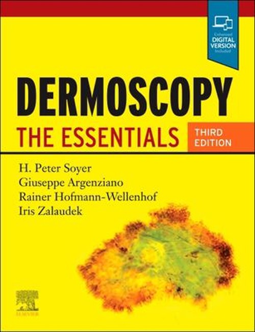 Dermoscopy : The Essentials Paperback
