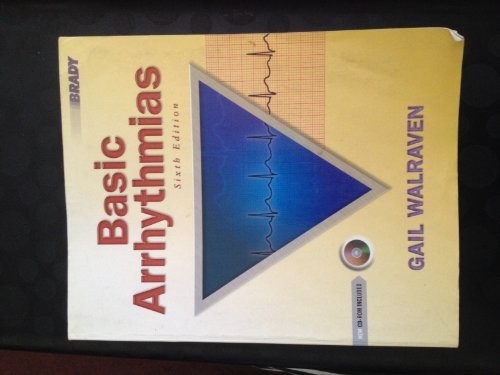 Basic Arrhythmias, Walraven, Gail