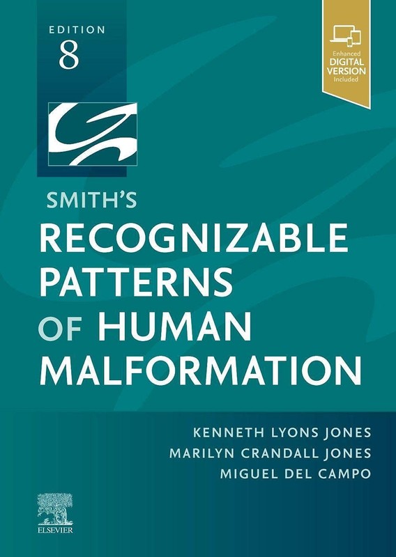 SMITH’S RECOGNIZABLE PATTERNS OF HUMAN MALFORMATION: EXPERT CONSULT – ONLINE AND