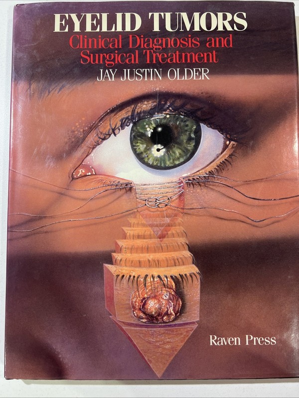 Eyelid, Tumors: Clinical Diagnosis And Surgical Treatment. By Jay Justin Older