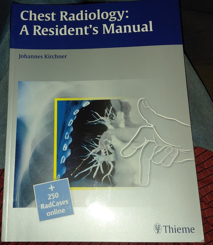 Chest Radiology : A Resident’s Manual, Paperback by Kirchner, Johannes