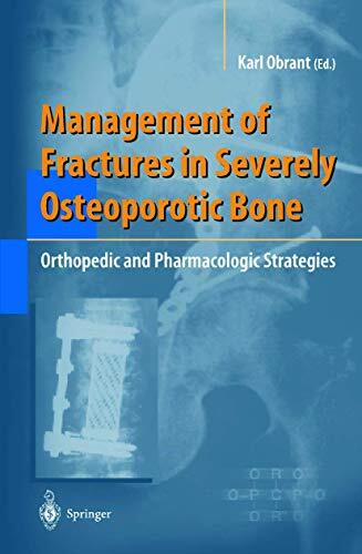 Management of Fractures in Severely Osteoporotic Bone: Orthopedic and Pharmac-,