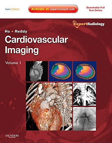 Cardiovascular Imaging, 2-Volume Set: Expert Radiology Series