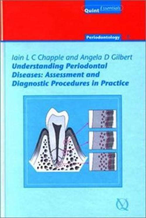 Understanding Periodontal Diseases : Assessment and Diagnostic Pr