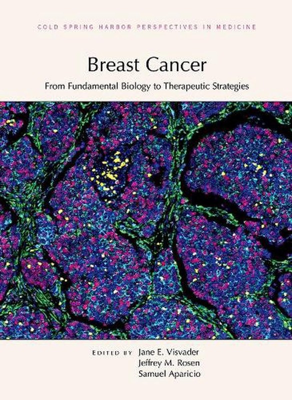 Breast Cancer: From Fundamental Biology to Therapeutic Strategies by Jane E. Vis