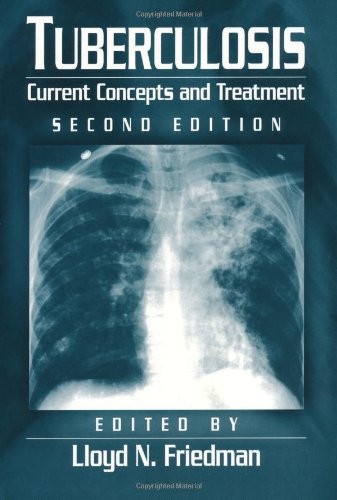 Tuberculosis: Current Concepts and Treatment, Second Edition