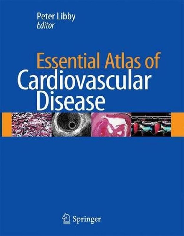 Essential Atlas of Cardiovascular Disease by Peter Libby (English) Hardcover Boo