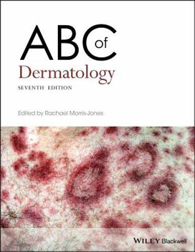 ABC of Dermatology by Rachael Morris-Jones: New