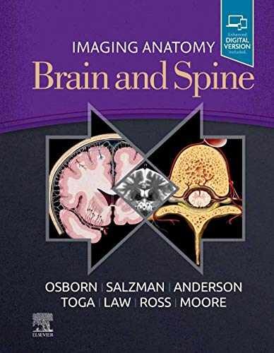 Imaging Anatomy Brain and Spine – Hardcover, by Osborn MD FACR Anne G.; – New