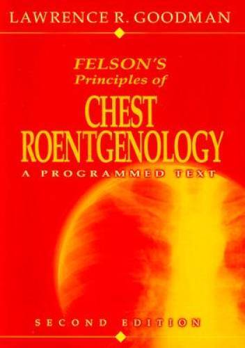 Felsons Principles of Chest Roentgenology: A Programmed Text – Paperback – GOOD