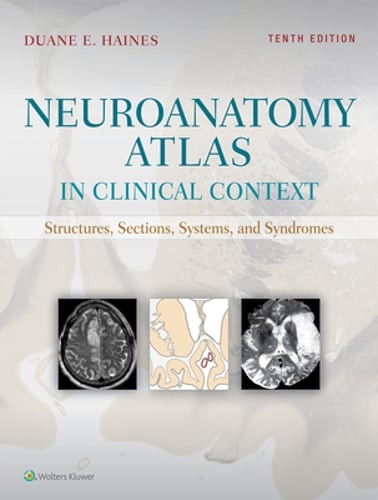 Neuroanatomy Atlas in Clinical Context: Structures, Sections, Systems, and: Used
