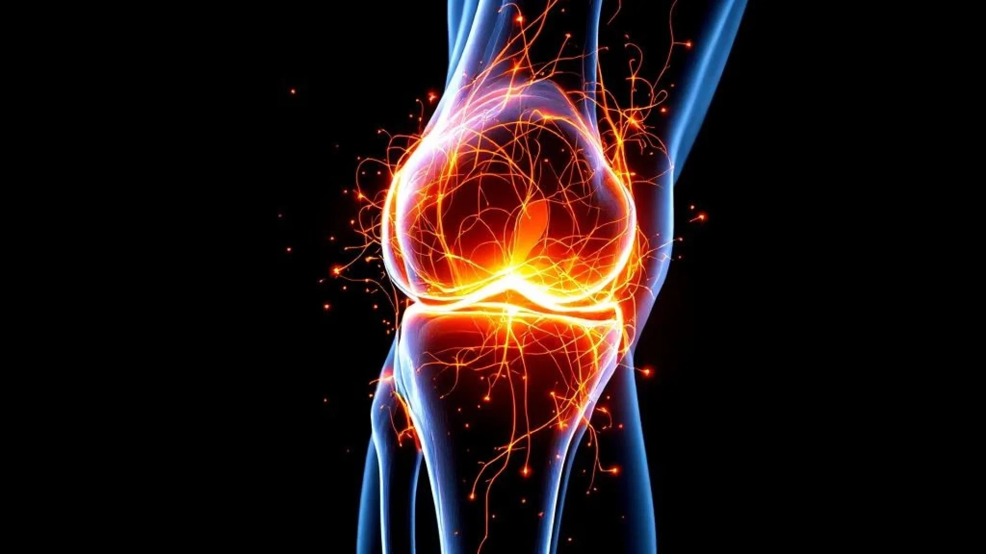 Doorsnede van menselijke knie met anatomische details, rode spanningslijnen en oranje drukpunten op zwarte achtergrond