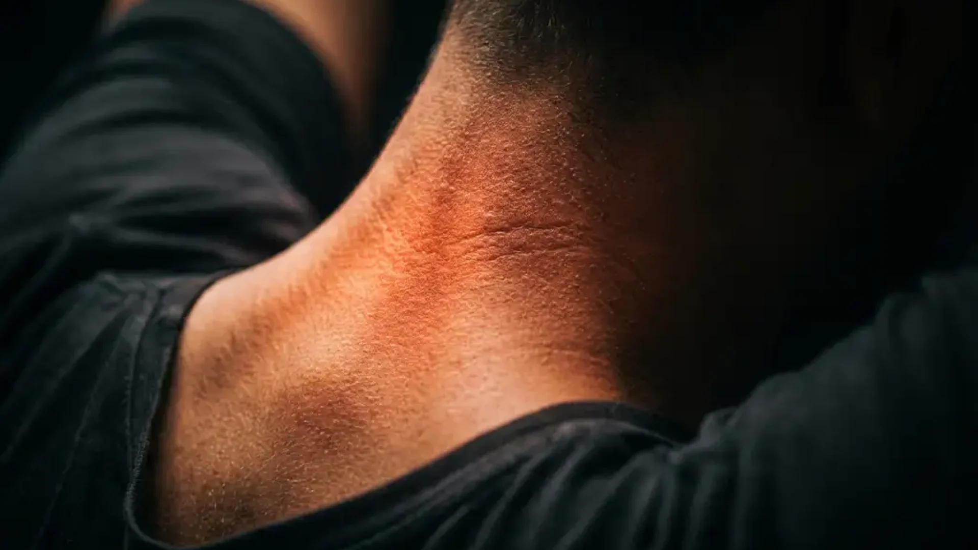 Nek en schouders van achteren met gloeiende roodoranje cervicale wervelkolom die pijn en ontstekking toont