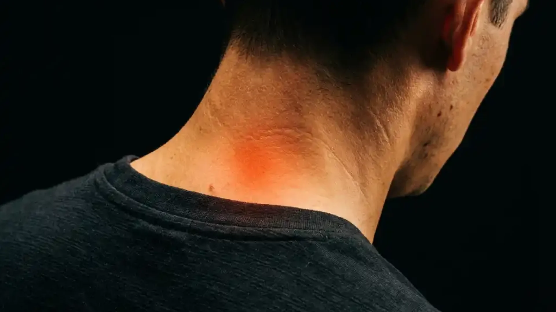 Persoon van achteren met rode gloed die nekpijn en gespannen spieren in de cervicale regio toont